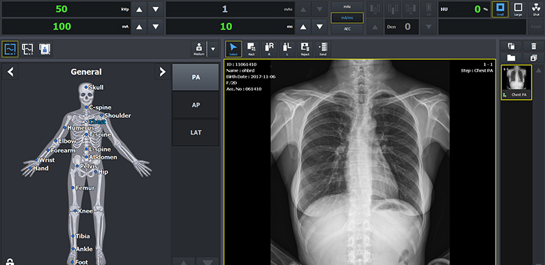x-ray of body and chest
