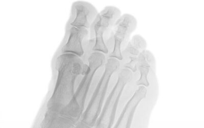 Podiatry Solutions